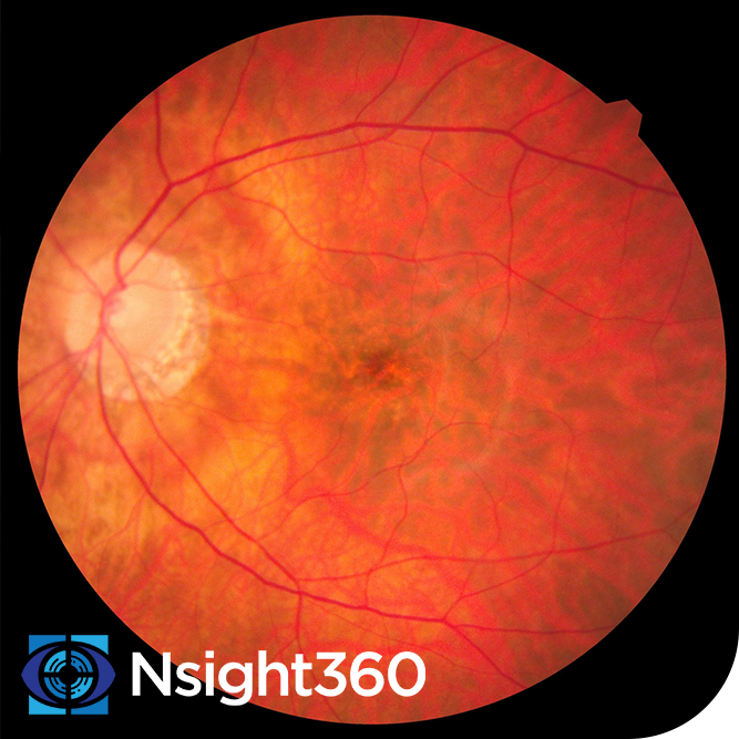 retina scan using Nsight360